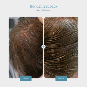Keratin Hair Booster - Men