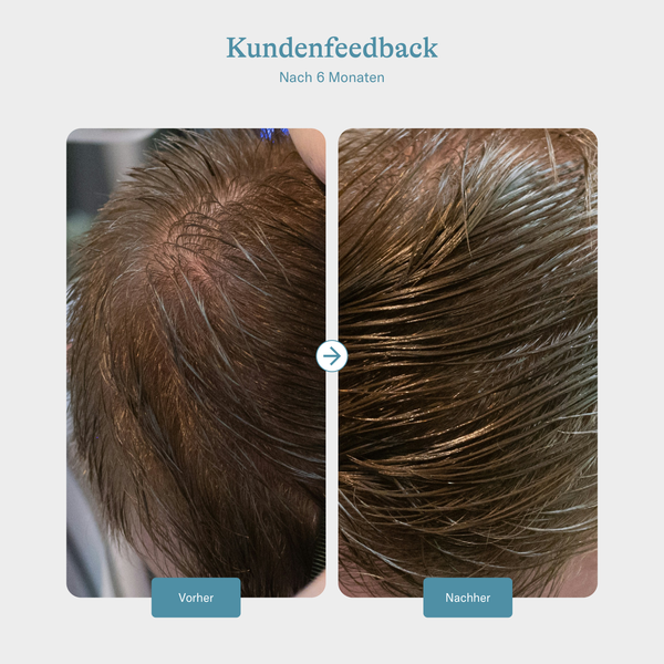 Keratin Hair Booster - Men